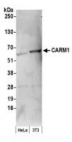 Detection of human and mouse CARM1 by we