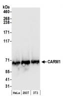 Detection of human and mouse CARM1 by we