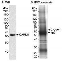 Detection of human CARM1 by western blot