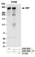 Detection of human CBP by western blot o