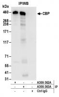 Detection of human CBP by western blot o