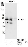 Detection of human CBX8 by western blot