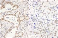 click to view larger size Detection of human and mouse CCAR1 by im