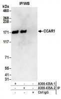 click to view larger size Detection of human CCAR1 by western blot