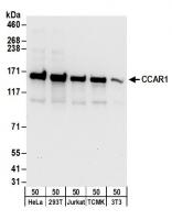 click to view larger size Detection of human and mouse CCAR1 by we