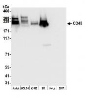 Detection of human CD45 by western blot.