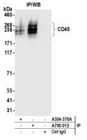 Detection of human CD45 by western blot
