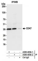 Detection of human CDK7 by western blot