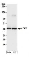 Detection of human CDK7 by western blot.