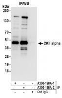 Detection of human CKII alpha by western