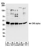 Detection of human and mouse CKII alpha