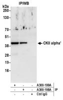 Detection of human CKII alpha' by wester