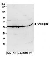 Detection of human and mouse CKII alpha'