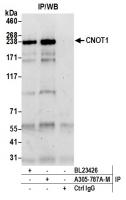 Detection of human CNOT1 by western blot
