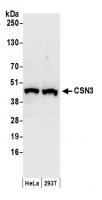 Detection of human CSN3 by western blot.