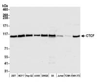 Detection of human CTCF by western blot.