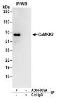 Detection of human CaMKK2 by western blo