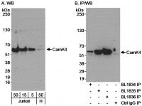 Detection of human CamK4 by western blot