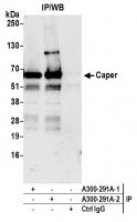 Detection of human Caper by western blot