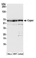 Detection of human Caper by western blot