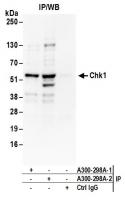 Detection of human Chk1 by western blot