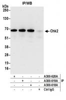 Detection of human Chk2 by western blot