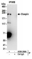 Detection of human Claspin by western bl