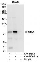 Detection of human CoAA by western blot