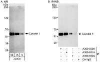 Detection of human Coronin 1 by western