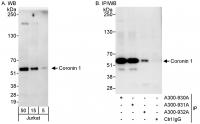 Detection of human Coronin 1 by western