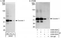 Detection of human Coronin 1 by western