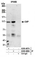Detection of human CtIP by western blot