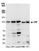Detection of human and mouse CtIP by wes