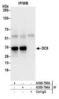 Detection of human DC8 by western blot o