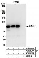 Detection of human DDX21 by western blot