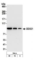 Detection of human DDX21 by western blot