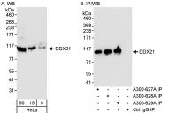 Detection of human DDX21 by western blot