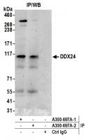 Detection of human DDX24 by western blot
