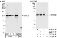 Detection of human DDX24 by western blot