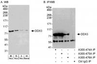 Detection of DDX3 by western blot and im