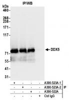 Detection of human DDX5 by western blot