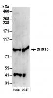 Detection of human DHX15 by western blot