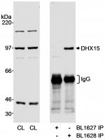 Detection of human DHX15 by western blot