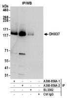 Detection of human DHX37 by western blot
