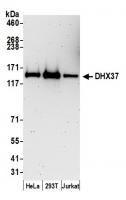 Detection of human DHX37 by western blot