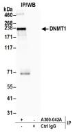 Detection of human DNMT1 by western blot