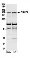 Detection of human DNMT1 by western blot