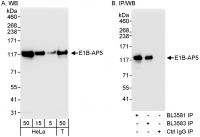 Detection of human E1B-AP5 by western bl