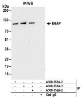 Detection of human E6AP by western blot