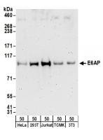 Detection of human and mouse E6AP by wes